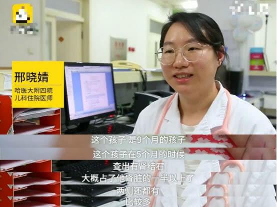 家长给9个月大宝宝过量补钙，致其长出大量肾结石，还无法做手术