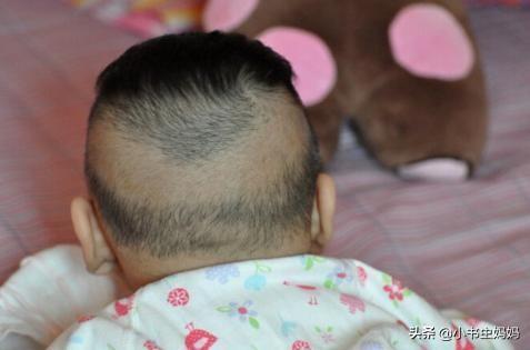 满月宝宝出现枕秃，需要补钙吗？医生说：弄清原因再决定是否补钙
