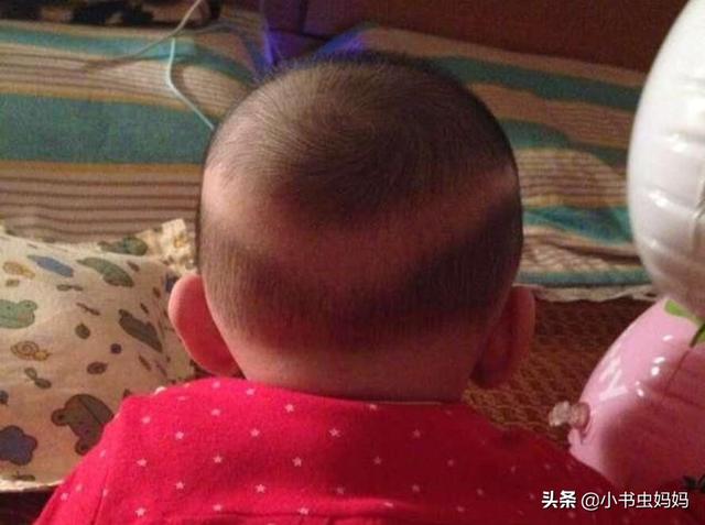 满月宝宝出现枕秃，需要补钙吗？医生说：弄清原因再决定是否补钙