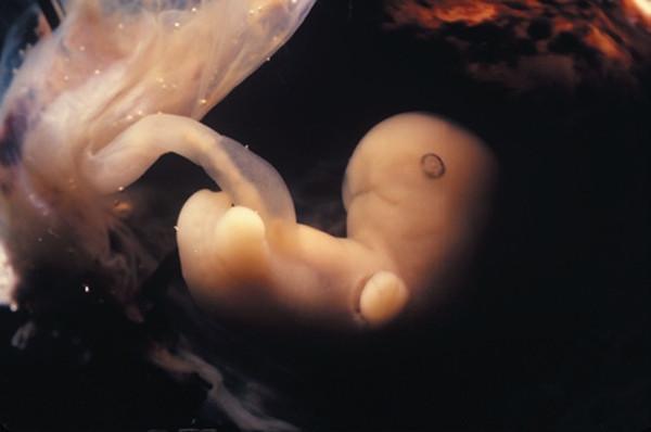怀孕5周胎儿图片欣赏图片