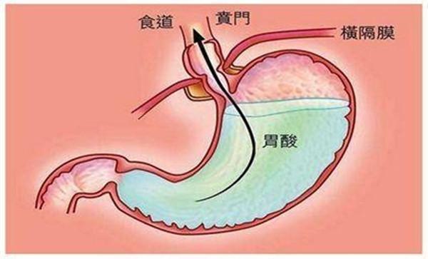 怀孕4种局部疼痛让孕妈妈不敢生二胎，别担心，居家护理有妙招