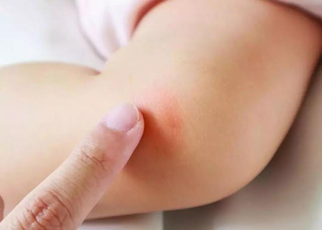 宝妈们！这些常用中药宝宝霜都含激素！你中招了没？