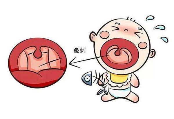 宝宝被鱼刺卡喉可以喝醋？别信土办法，科学处理靠5招