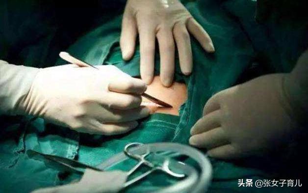 剖腹产后必须要平躺6小时，顺产却不用，这下终于知道原因了
