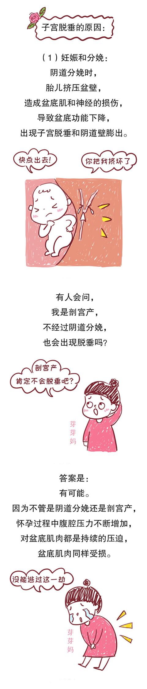 拿什么拯救你？产后妈妈的子宫脱垂，一个相避也无法避开的问题