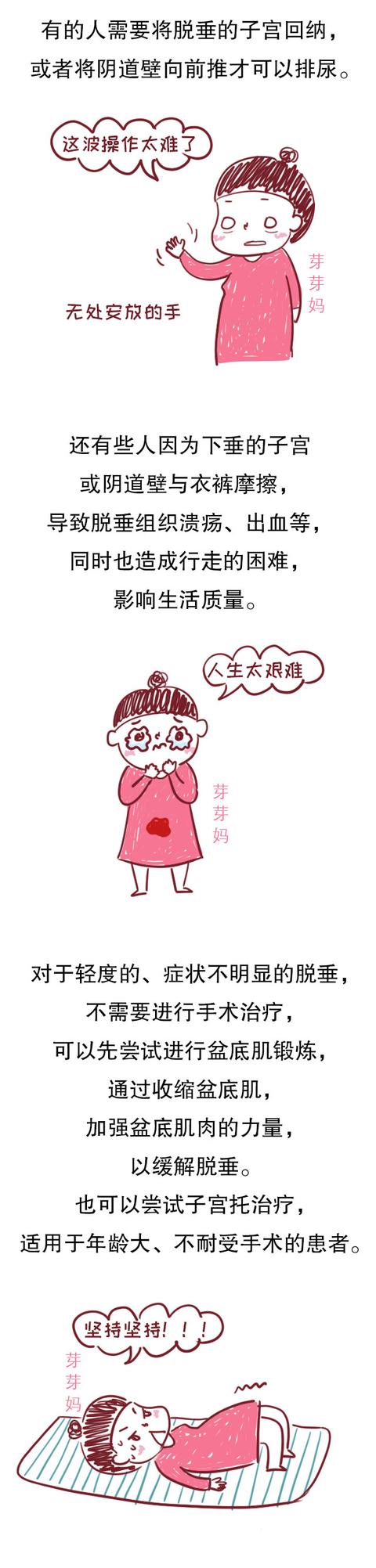 拿什么拯救你？产后妈妈的子宫脱垂，一个相避也无法避开的问题