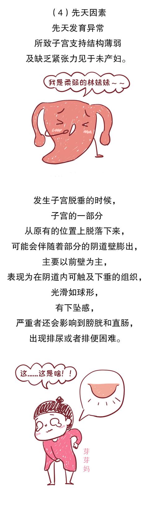 拿什么拯救你？产后妈妈的子宫脱垂，一个相避也无法避开的问题