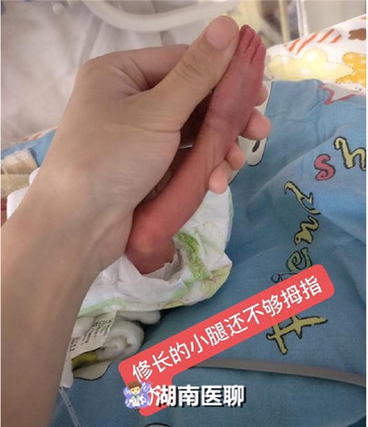 不抛弃不放弃，73天生命接力，“870克宝宝”跑赢死神