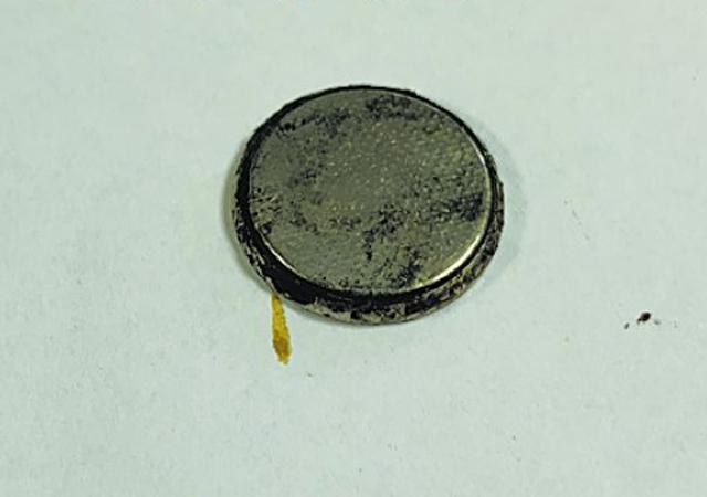 一岁宝宝误吞纽扣电池，送急诊后食管已感染，这张照片值得反省