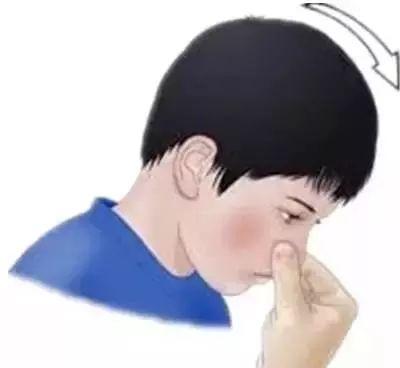 孩子流鼻血，仰头、塞卫生纸正确吗？