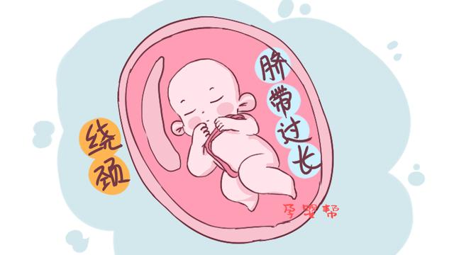 脐带绕颈不要慌！孕妈学会“引导”，聪明的宝宝会自行脱困