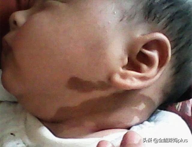 孕妇这4种爱好，小心胎记找上婴儿，不想被孩子抱怨要注意