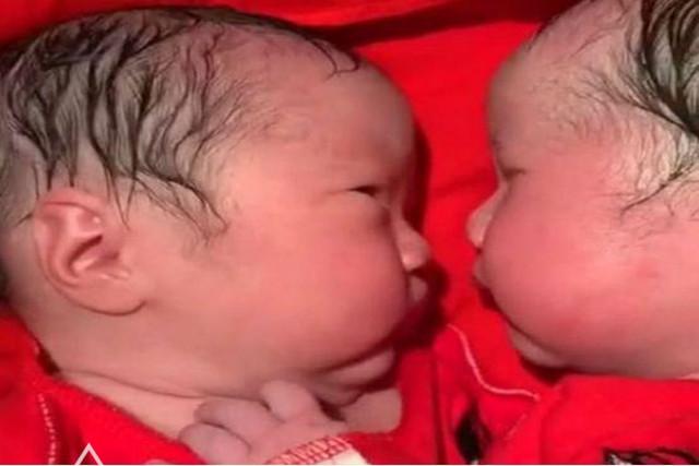 双胞胎出生20分钟，妹妹对姐姐的暖心“举动”，感动在场很多人