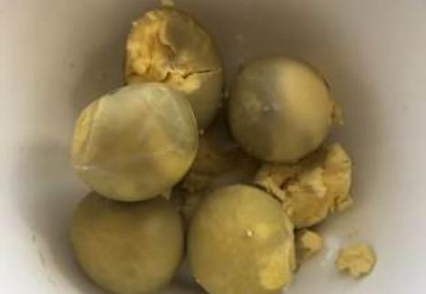 水煮蛋黄“发黑”，到底能不能吃？别再让小孩乱吃了，不懂快看