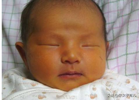 不想宝宝出生后有黄疸？孕妈要做好这几件事，对宝妈和胎儿都好