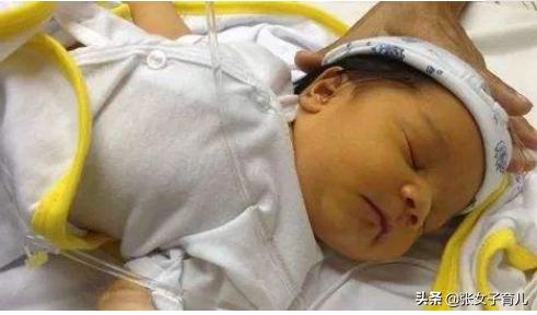 不想宝宝出生后有黄疸？孕妈要做好这几件事，对宝妈和胎儿都好