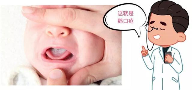 宝宝不好好吃饭？也有可能得了这种病！快看看你家宝宝是这样吗？