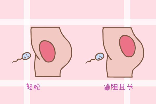 怀孕之后，孕妈胎盘前壁好还是后壁好？这种位置很危险，可别大意