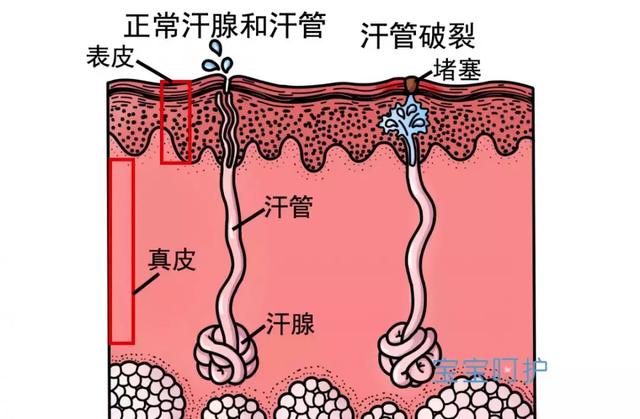 夏天带娃最容易干架的一件事，听老人的就是害了娃