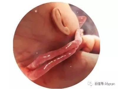 这些传言医生都说了不靠谱，别太傻