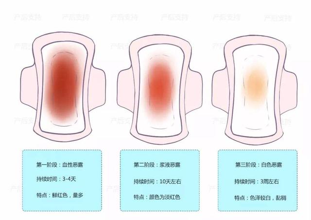 产后恶露不尽怎么办？7个关键点，做到可预防