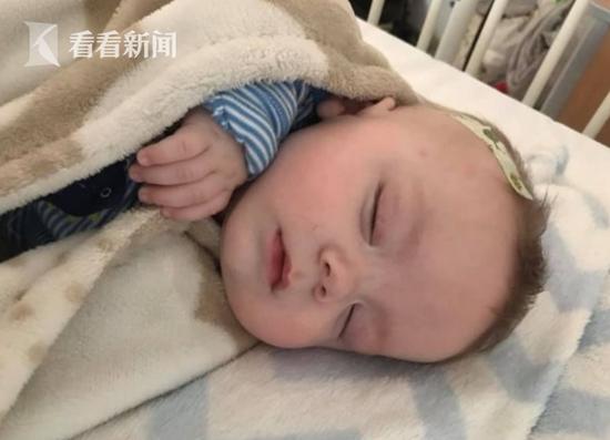 被陌生人拥抱亲吻怎么回事 小孩眼睛肿胀还长出水泡