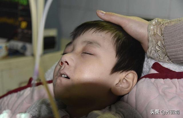 孩子流鼻血应该仰着头？殊不知这样做会导致孩子窒息