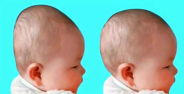 很多老人都喜欢给孩子睡“扁头”，真的好吗？父母早知道早受益