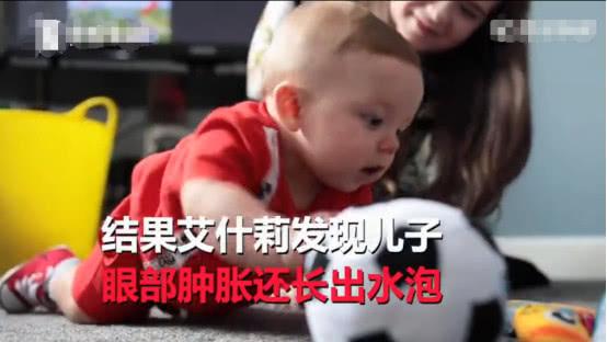 小宝宝被人亲了一下，不久后差点失明，住院两个半月才康复