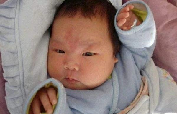 孩子身上有胎记？那是宝妈在怀孕时的这5个坏习惯，埋下的“根”