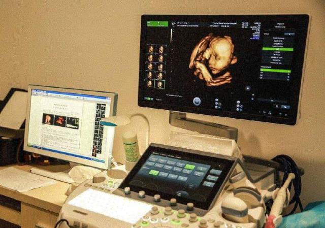 四维彩超过关了，胎儿就可以健康出生了吗？看完你就知道了