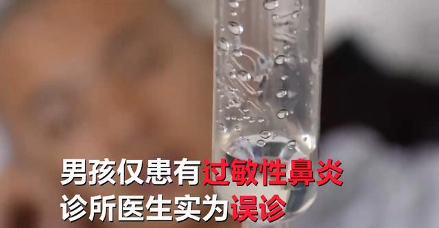 听信偏方！13岁男孩感冒乱涂药，结果2个鼻孔变成1个