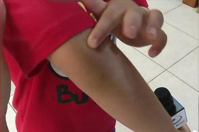 宝宝屁股上有淤青，这位妈妈的调查维权方式，长见识了