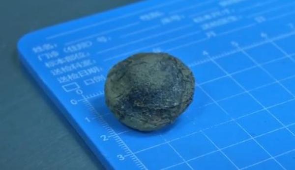 男孩误吞杏核差点要命 医生紧急抢救 发现背后的原因太让人心疼