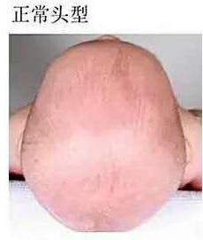 宝宝偏头，是因为睡觉姿势不变？宝妈这时候辛苦点，宝宝以后受益