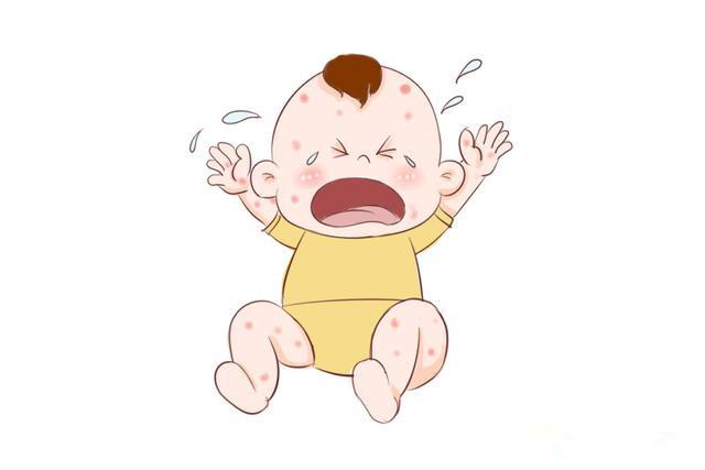 夏日疹子大作战！异位性皮肤炎乳液怎么擦？