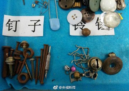 这些都是曾被孩子误吞的物品！转给宝爸宝妈