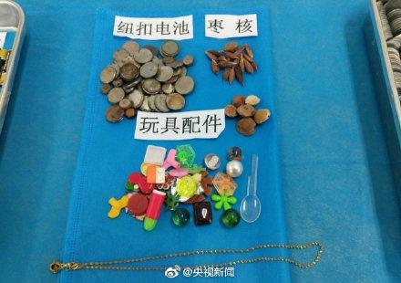 这些都是曾被孩子误吞的物品！转给宝爸宝妈