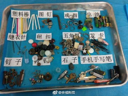 这些都是曾被孩子误吞的物品！转给宝爸宝妈