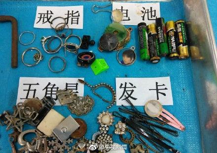 这些都是曾被孩子误吞的物品！转给宝爸宝妈