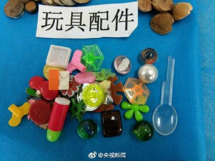 这些都是曾被孩子误吞的物品！转给宝爸宝妈
