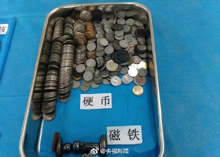 这些都是曾被孩子误吞的物品！转给宝爸宝妈
