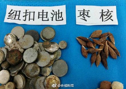 这些都是曾被孩子误吞的物品！转给宝爸宝妈