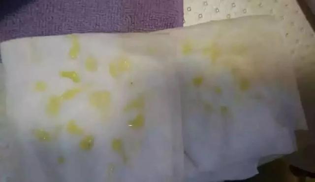 断奶后不排残奶 = 致癌？排残奶究竟排的是什么？