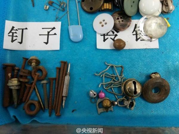 被熊孩子吞过的异物