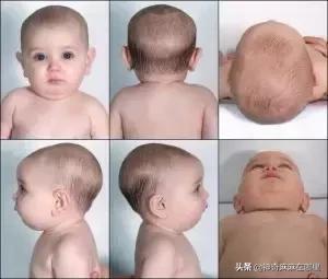 怎么塑造宝宝好头型？如何给娃挑枕头？学问深着呐