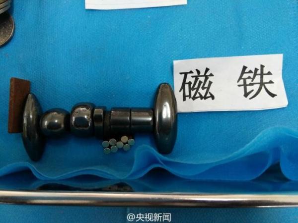 被熊孩子吞过的异物
