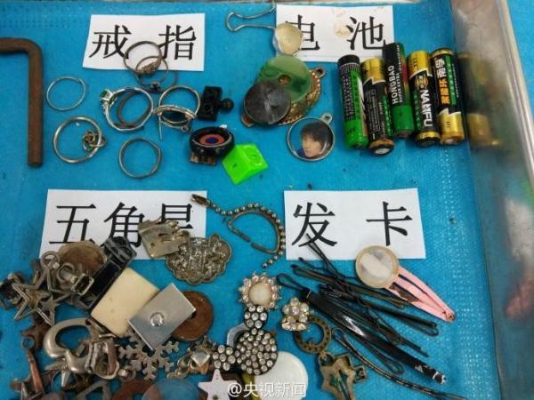 被熊孩子吞过的异物