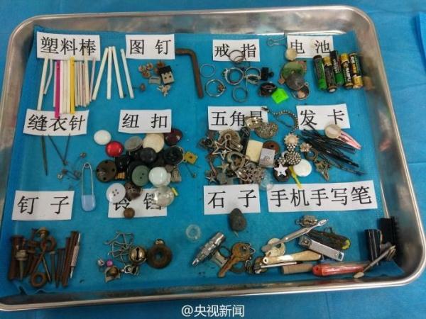 被熊孩子吞过的异物