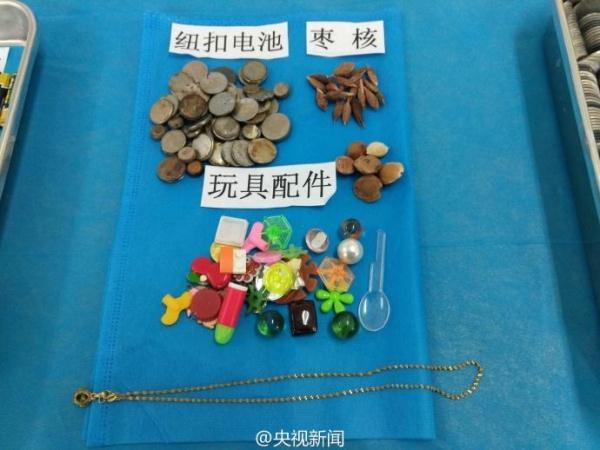 被熊孩子吞过的异物